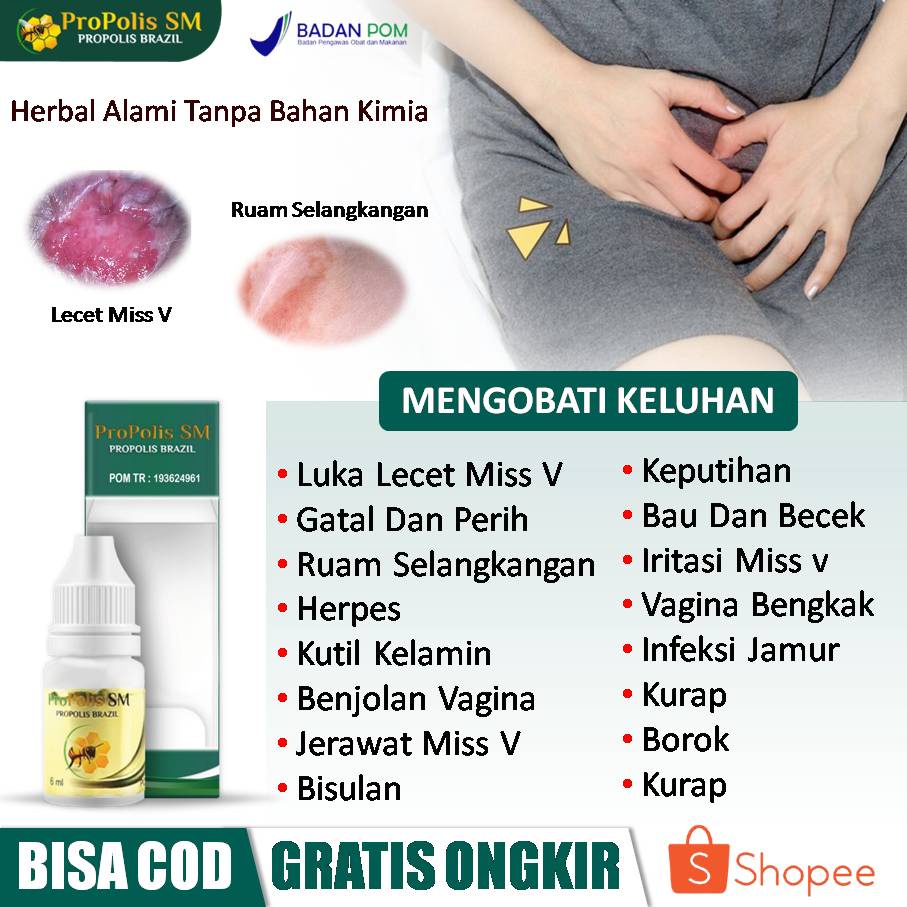 Jual Obat Vagina Lecet Miss V Gatal Dan Perih Ruam Selangkangan Herpes Genital Kutil Kelamin