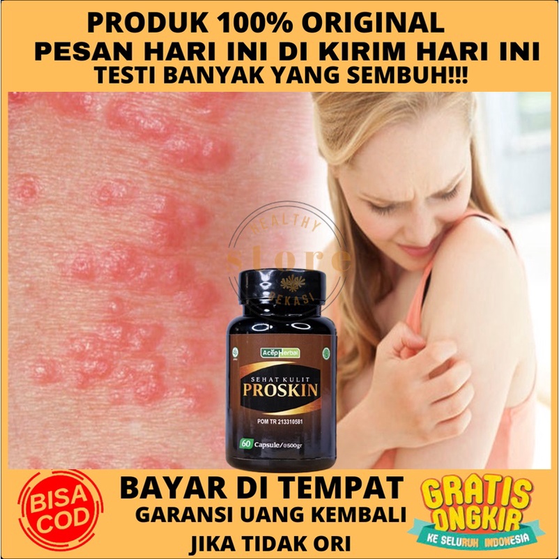 Jual Obat Scabies Manusia , Obat Gatal Karena Tungau, Obat Gatal ...