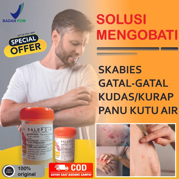 Jual Obat Salep Gatal Paling Ampuh Salep Zwafel 24 Original Untuk Gatel ...