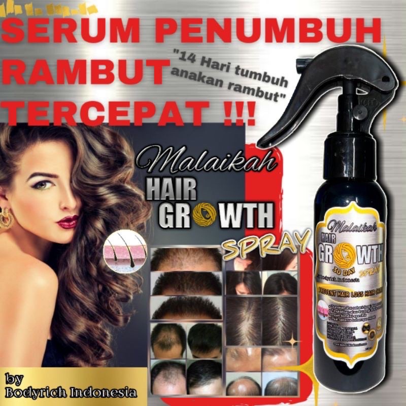 Jual Serum Obat Penumbuh Rambut Botak dan Rontok Parah Malaikah Hair ...
