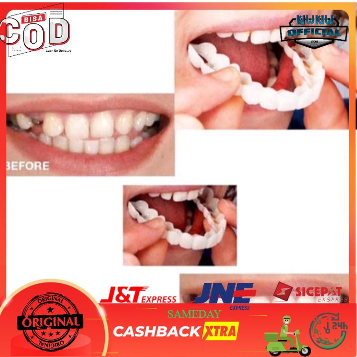Jual Gigi Palsu 100% Gigi Palsu Instan Atas Snap On Smile Gigi Palsu ...