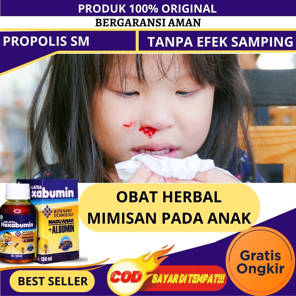 Jual Obat mimisan anak, Sariawan, Keluar darah dari hidung, Pusing
