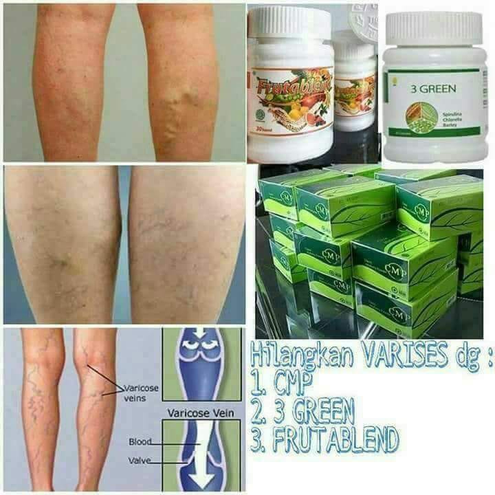 Jual CMP ( 30 Sachet ) | Shopee Indonesia