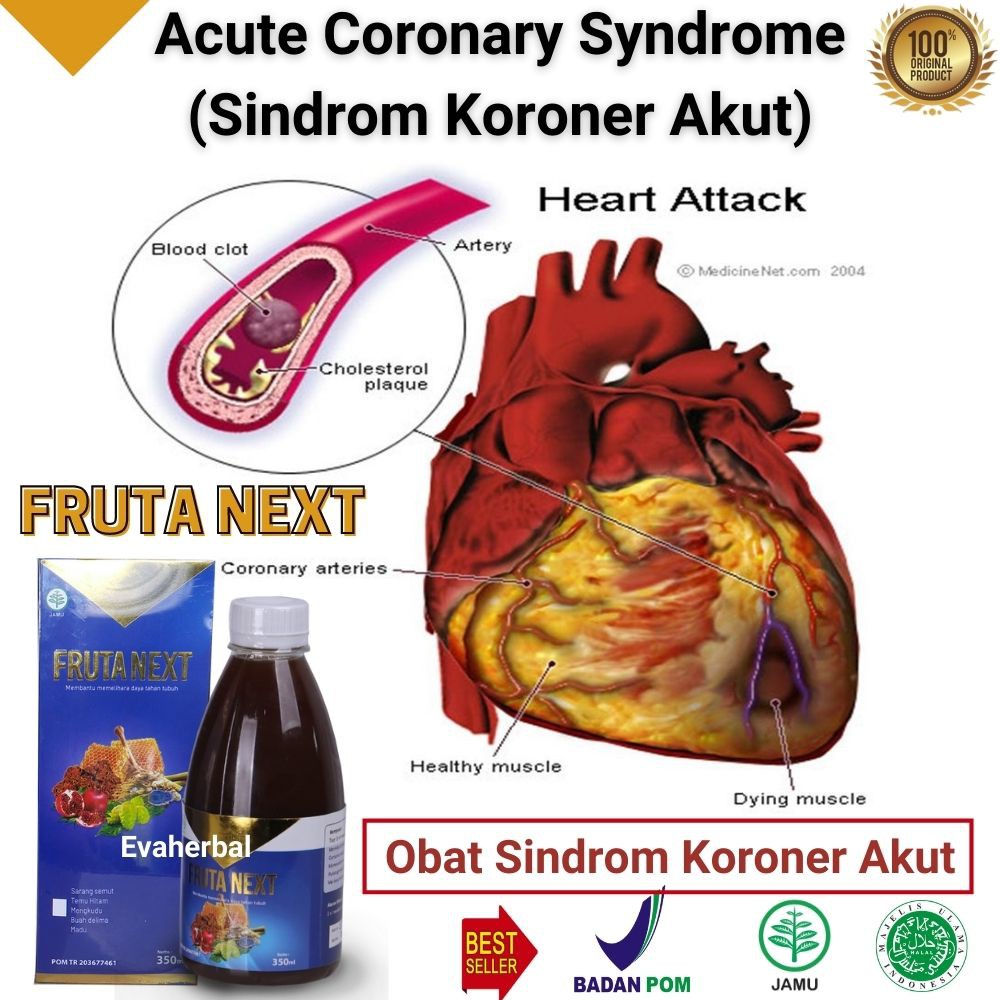 Jual FRUTANEXT Obat Jantung Koroner Acute Coronary Syndrome (Sindrom ...