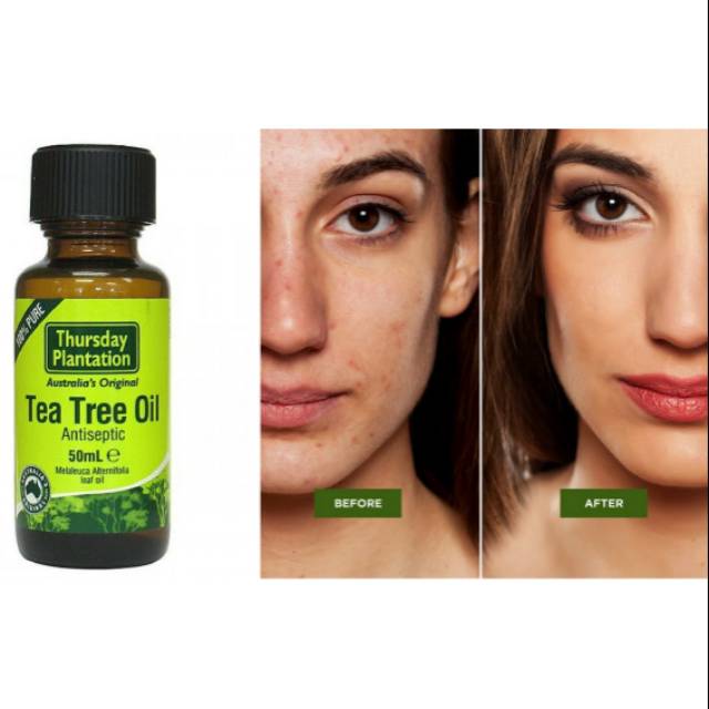 Jual Thursday Plantation 100% Pure Tea Tree Oil ....100ml.. original ...