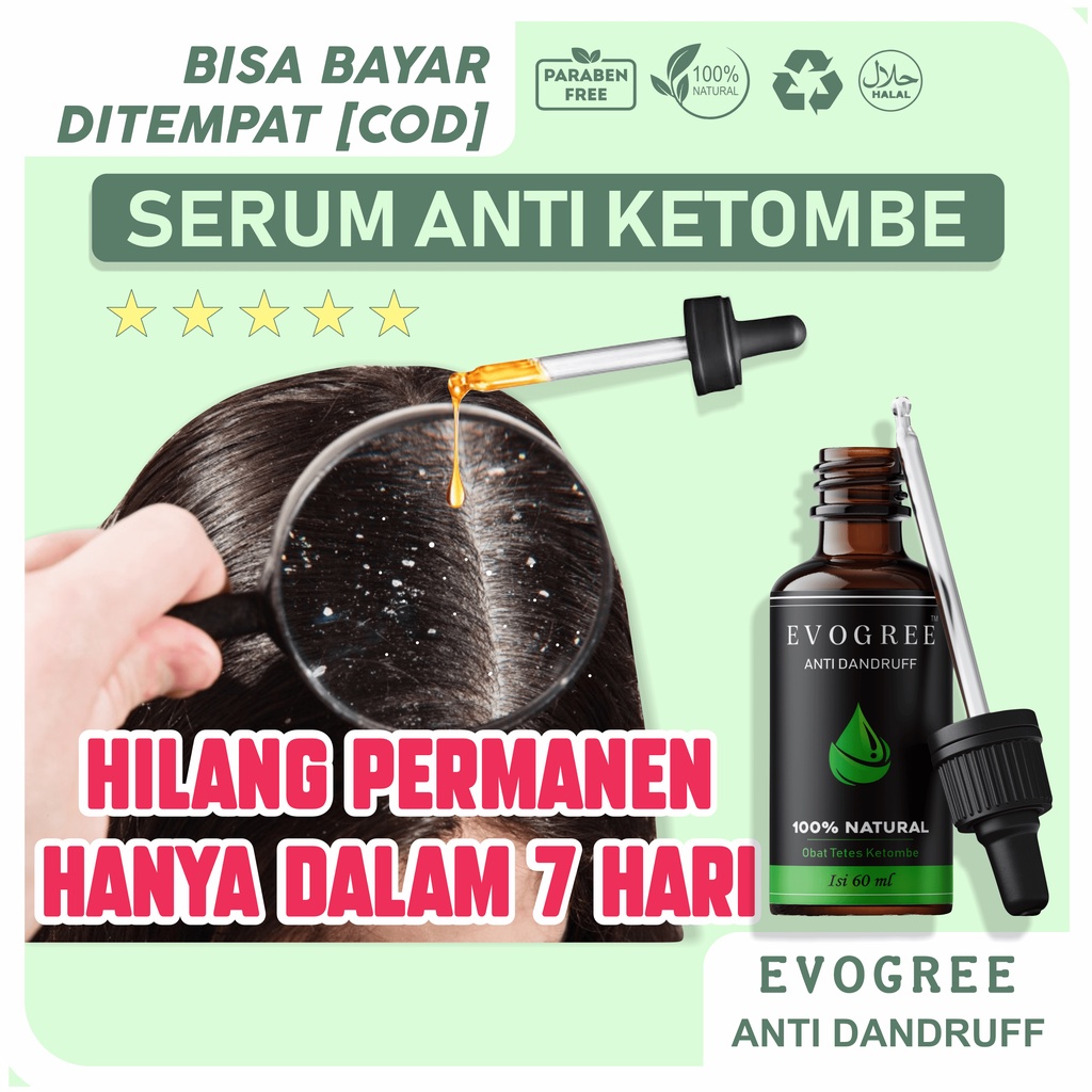 Jual Obat Ketombe Ampuh Tetes 100 Bahan Alami Dan Kepala Gatal Shopee Indonesia 3335