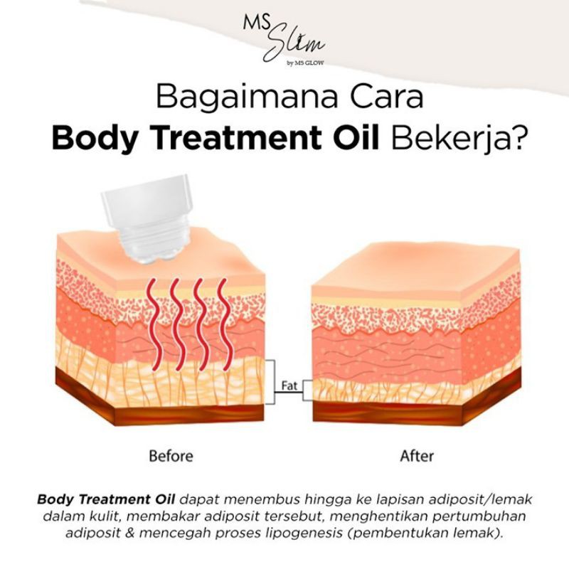 Jual MS Slim Body Treatment Oil | Shopee Indonesia
