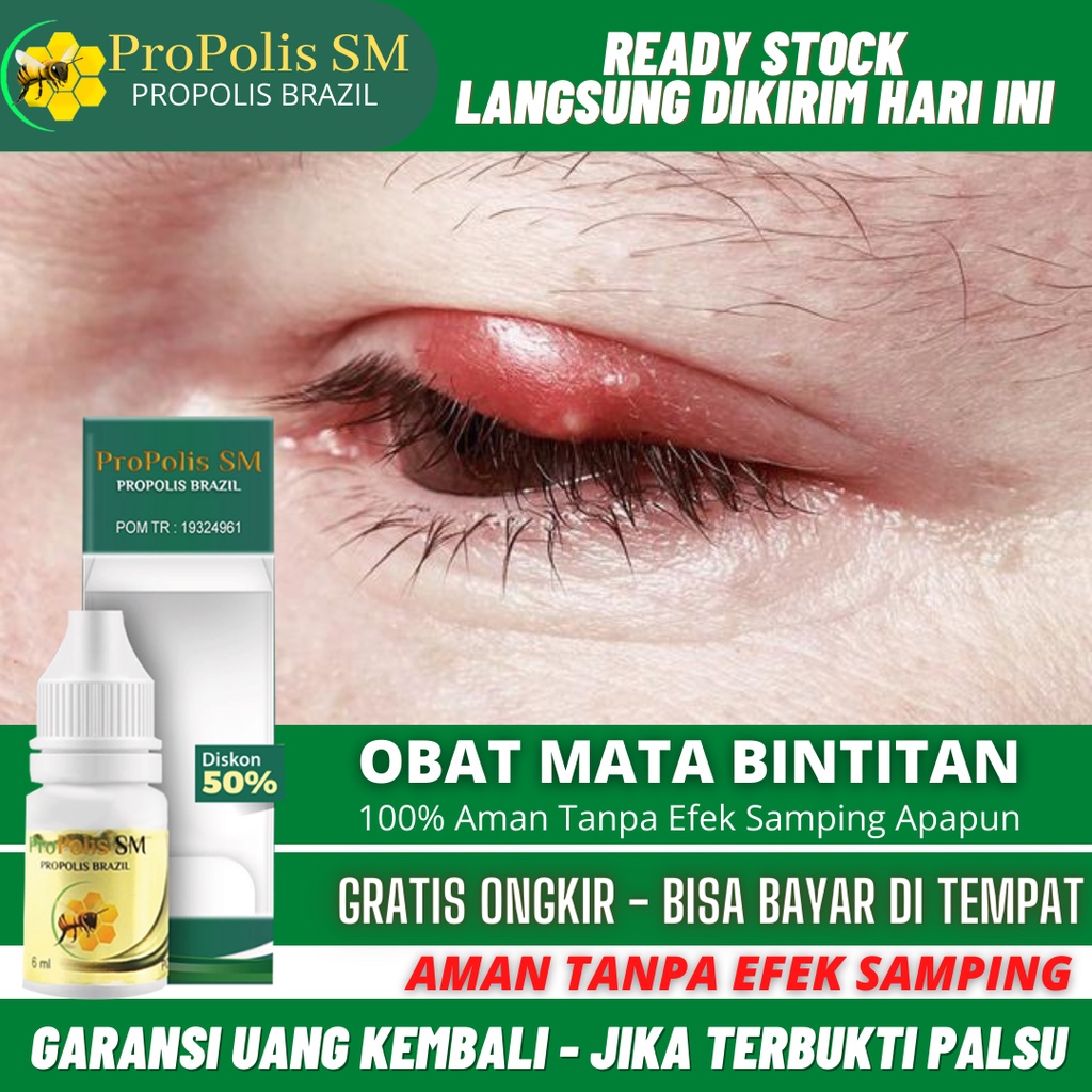 Jual Obat Mata Bintitan, Hordeolum / Bintitan, Mata Timbilan, Bintitan ...