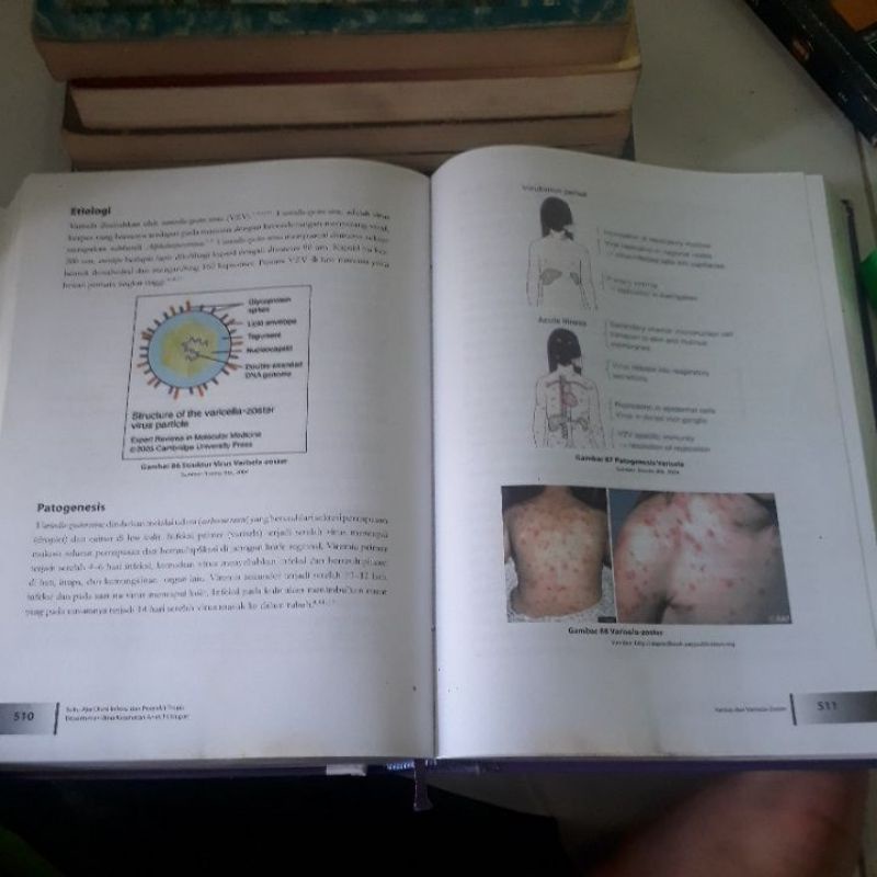 Jual BUKU AJAR DIVISI INFEKSI DAN PENYAKIT TROPIS (ORIGINAL) | Shopee ...