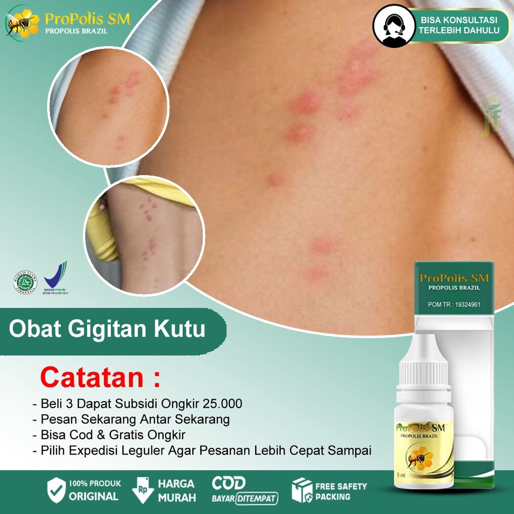 Jual Obat Luka Bekas Gigitan Kutu Penyakit Kulit Alergi Jamur Kusta