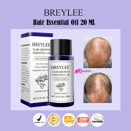 Jual Breylee Hair Essential Oil 20 Ml Clearance Exp 05 2024 Shopee