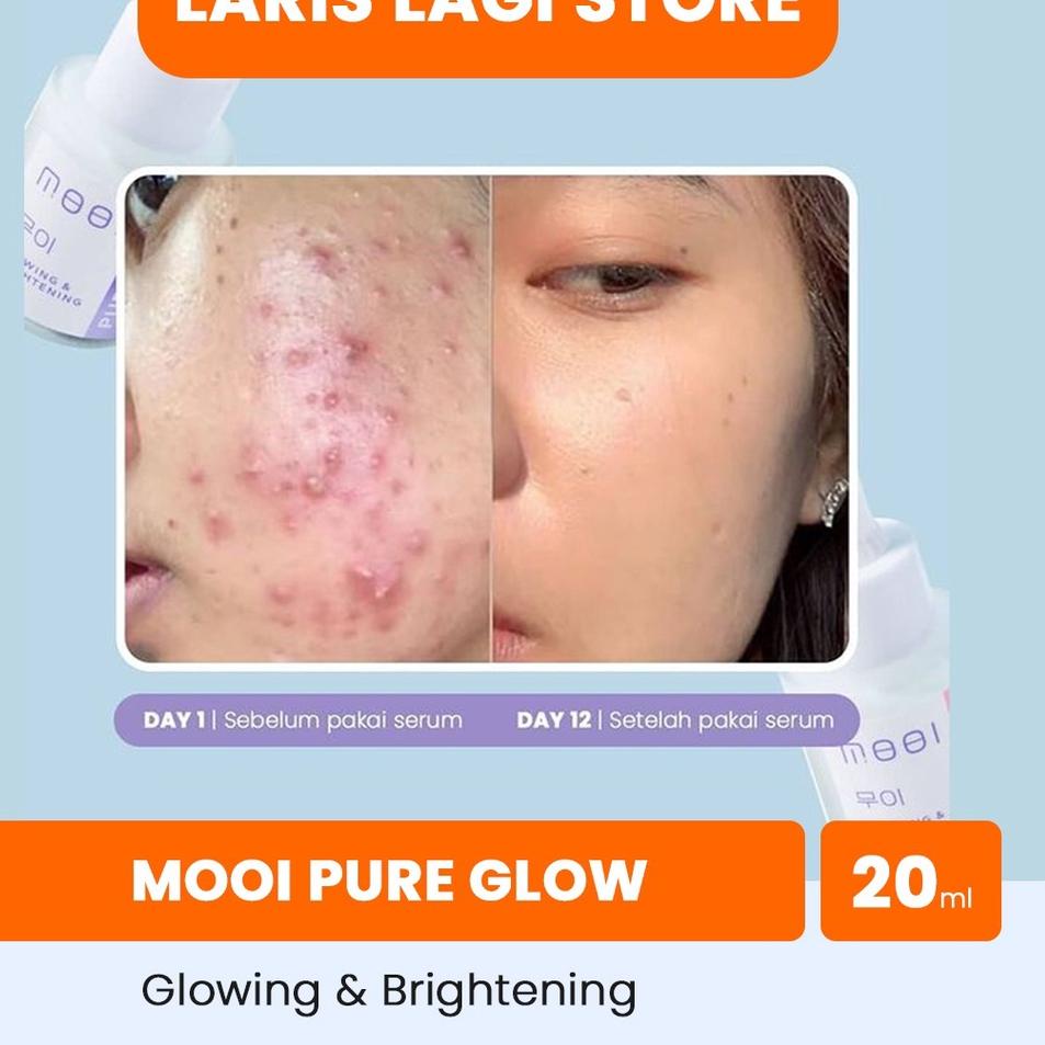 Jual Hemat Menarik Mooi Glow Serum - Serum Wajah Glowing Korea (BPOM ...