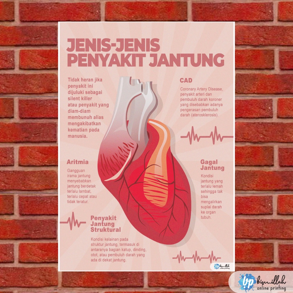 Jual Poster Kesehatan Jenis Penyakit Jantung Shopee Indonesia