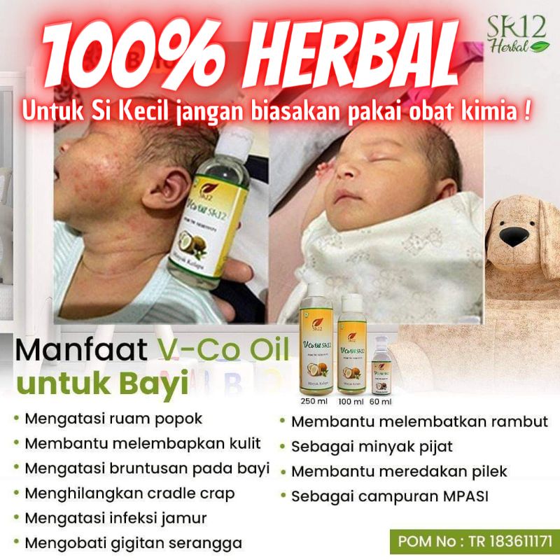 Jual VCO Bayi - Obat Gatal Gatal - Biang Keringat - Ruam Popok Bayi