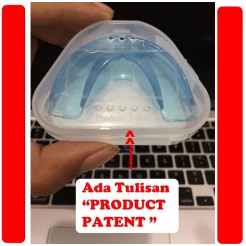 Jual alat meratakan gigi sama rata behel begel merapikan rapi ...