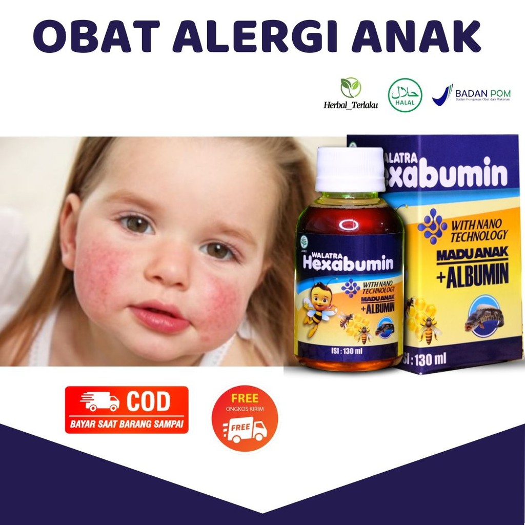 Jual Obat Alergi Khusus Anak , Ruam Merah , Bentol Kecil , Biduran