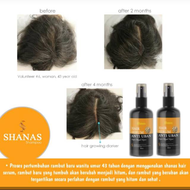 Jual Shanas Hair Serum Anti Uban 120ml Ptnatural Nusantara Nasa Shopee Indonesia 