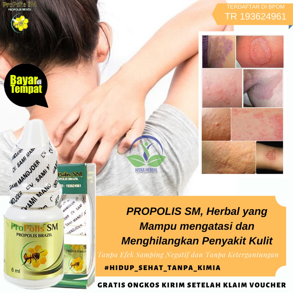 Jual Obat Gatal Di Ketiak Jamur Pada Ketek Akibat Panu Eksim Infeksi