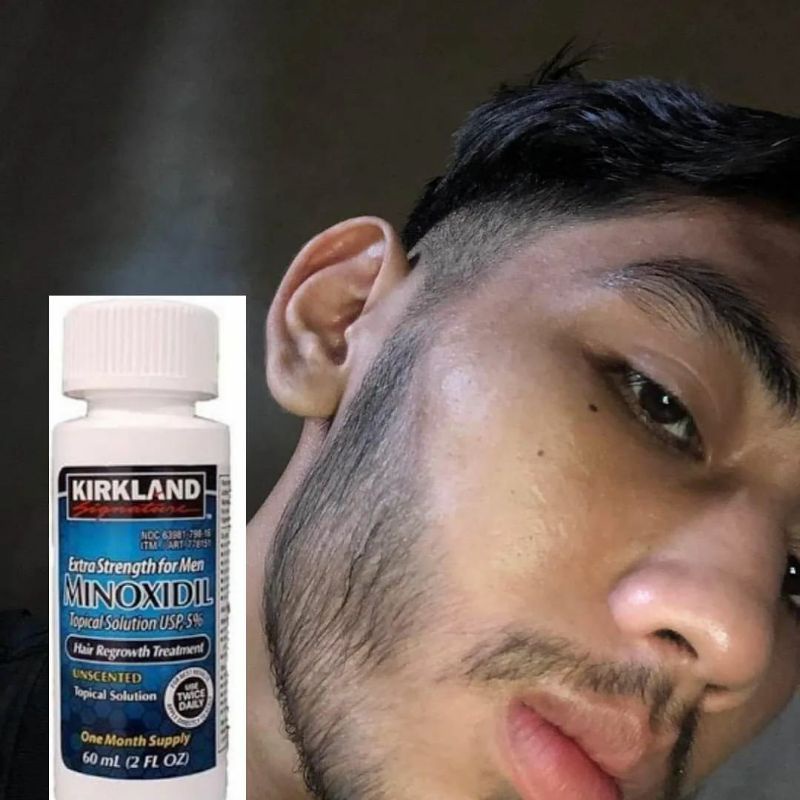 Jual minoxidil kirkland original 100 5minoxidil 60ml gratis pipet