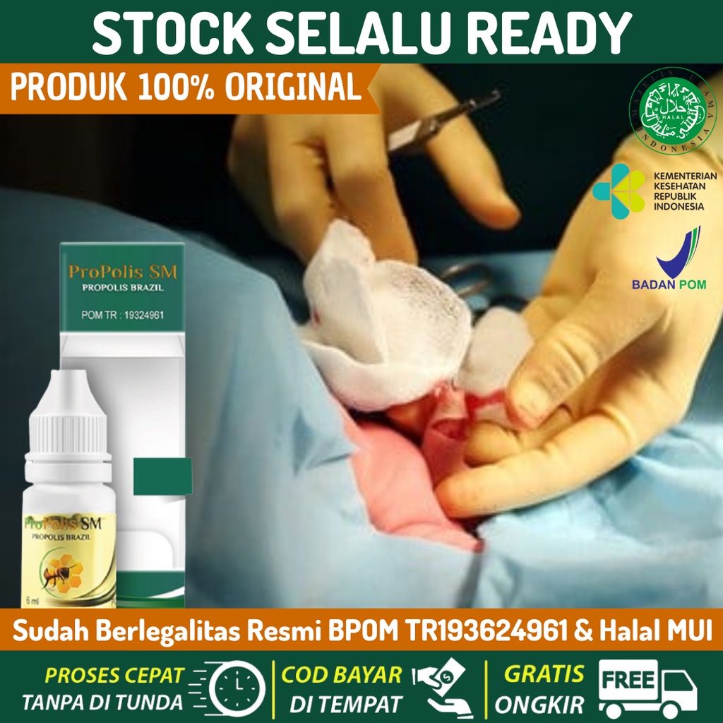 Jual Obat Tetes Pengering Luka Sunat Obat Pengering Luka Habis Sunat Khitan Salep 