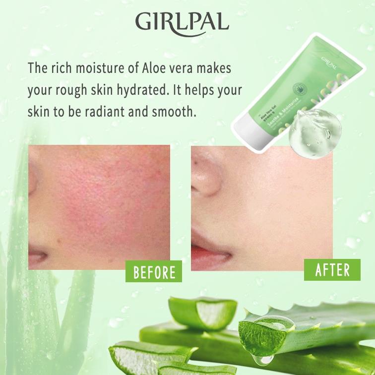 Jual 7M2 GIRLPAL Peeling Gel Centella Asiatica Body Exfoliating Facial