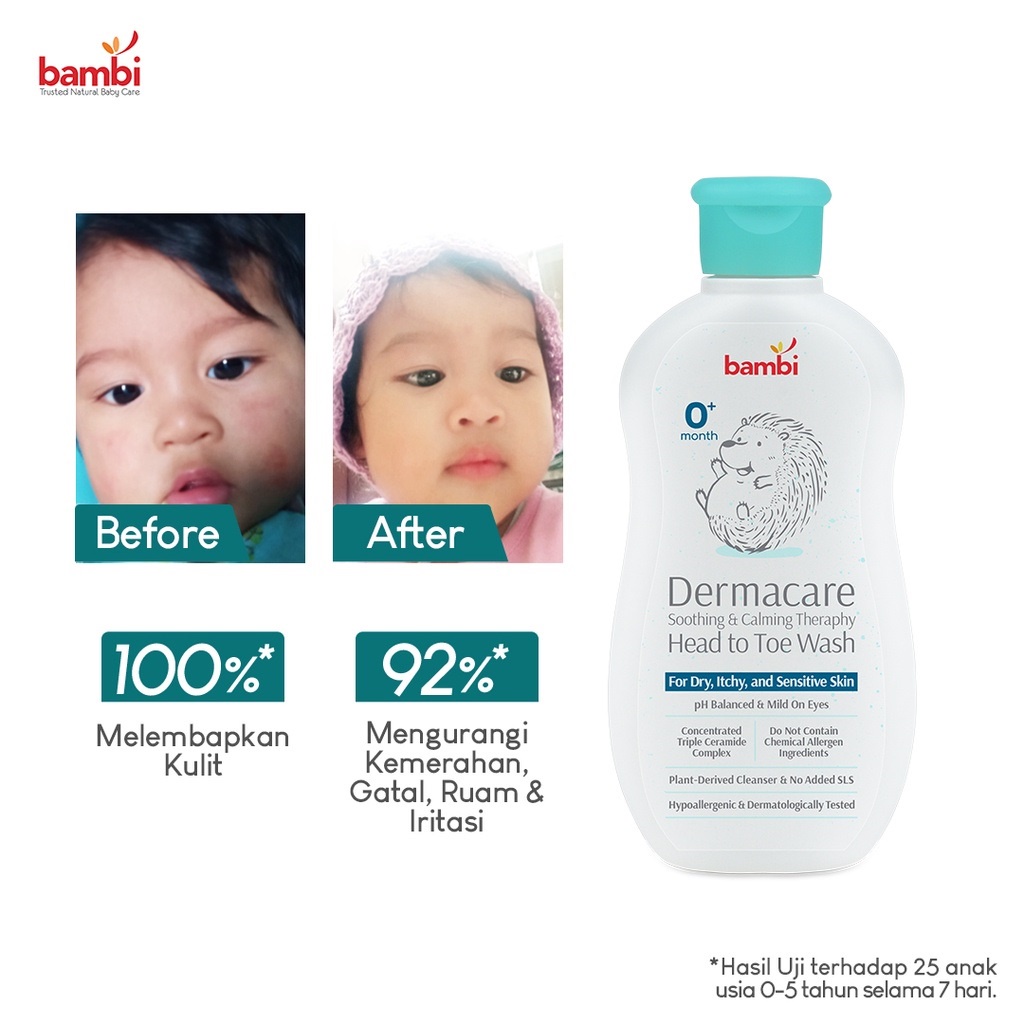 BAMBI Baby Dermacare Sabun dan Shampoo Bayi 200ml