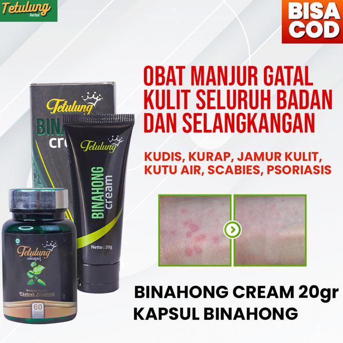 Jual Binahong Cream + Kapsul Obat Gatal Kulit Biduran / Kurap Paling ...