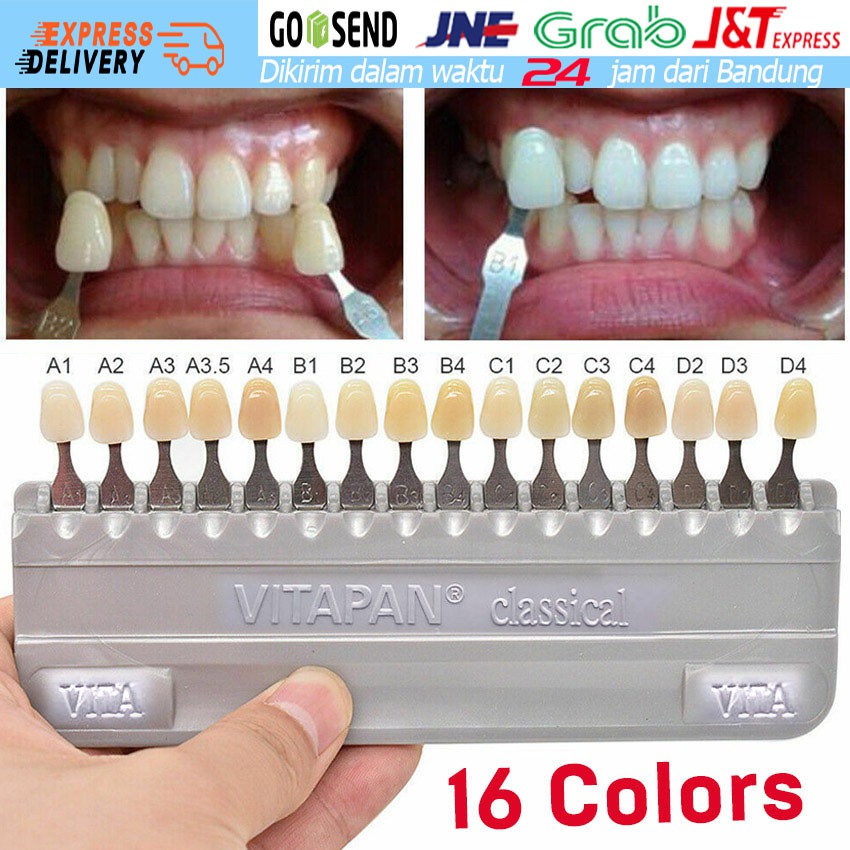 Jual Dental Bleaching Shade Guide VITA A1D4 / Acuan Warna Gigi