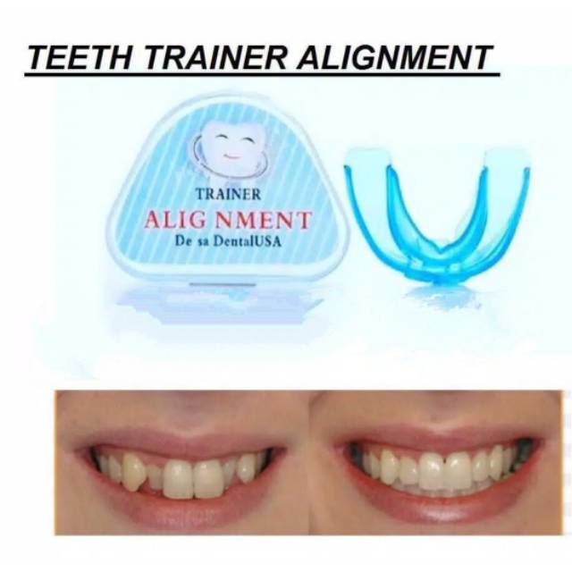 Jual Teeth Trainer Alignment Pelurus Merapihkan Gigi | Shopee Indonesia