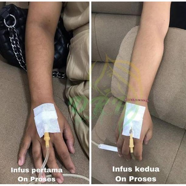 Jual Infus Japan Terlengkap & Harga Terbaru April 2026 | Shopee Indonesia