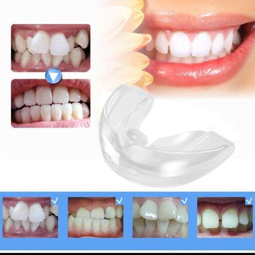 Jual Teeth trainer allignment orthodontic ORIGINAL alat perapih gigi ...