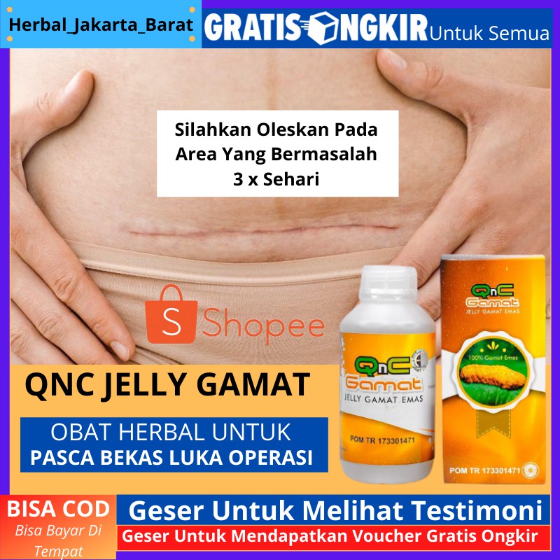 Jual Obat Untuk Luka Bekas Operasi Supaya Kering Obat Luka Operasi 