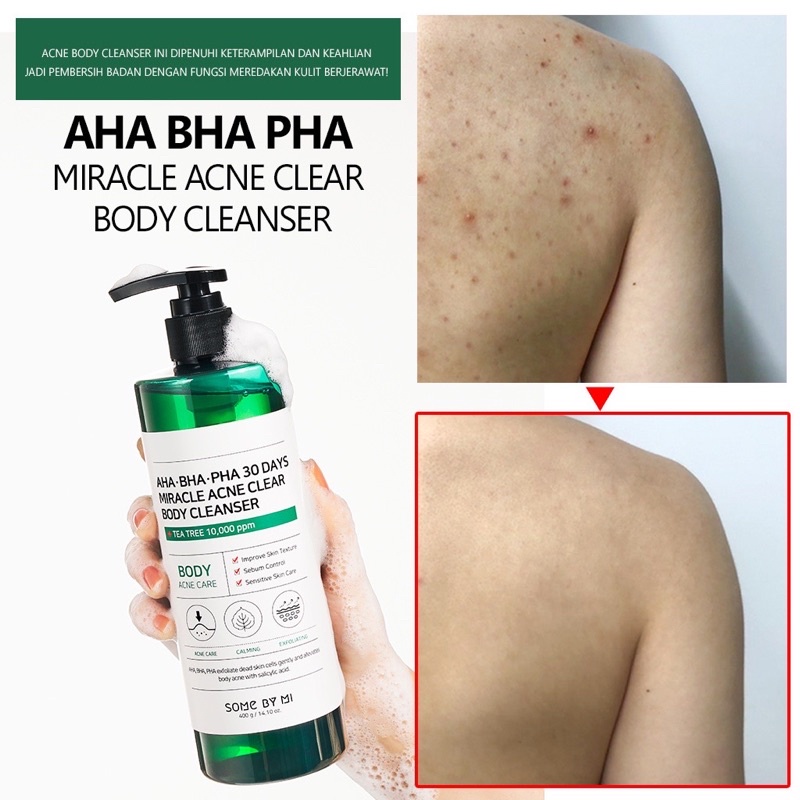 Jual SOMEBYMI AHA BHA PHA MIRACLE ACNE CLEAR BODY CLEANSER | Shopee ...