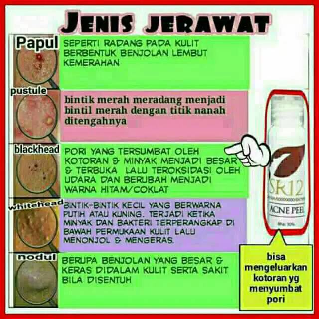 Jual ACNE FEEL SR12 / HOME FACIAL FEELING WITH AHA BHA | Shopee Indonesia