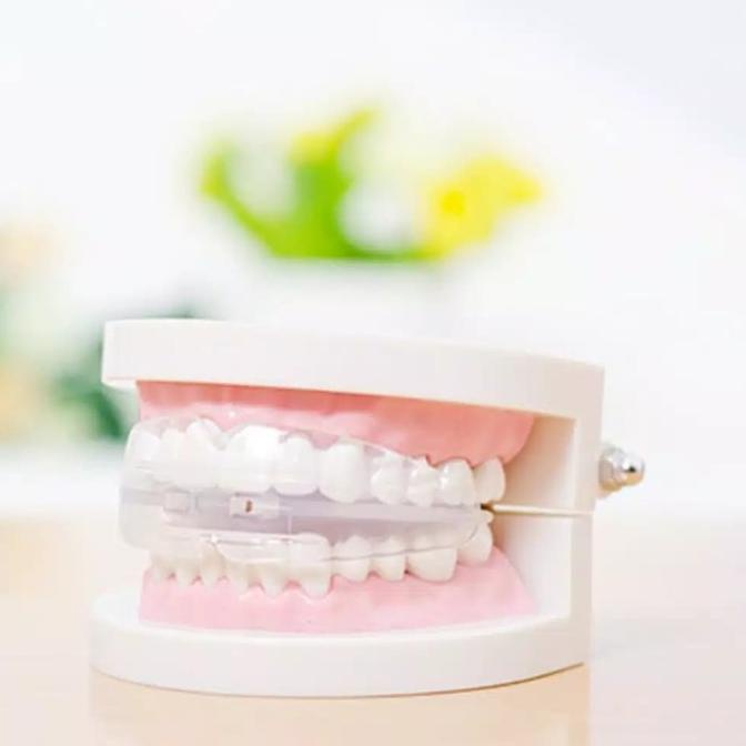 Jual Alat Merapikan Gigi Rahang Retainer Behel Gigi Dewasa Trainer ...