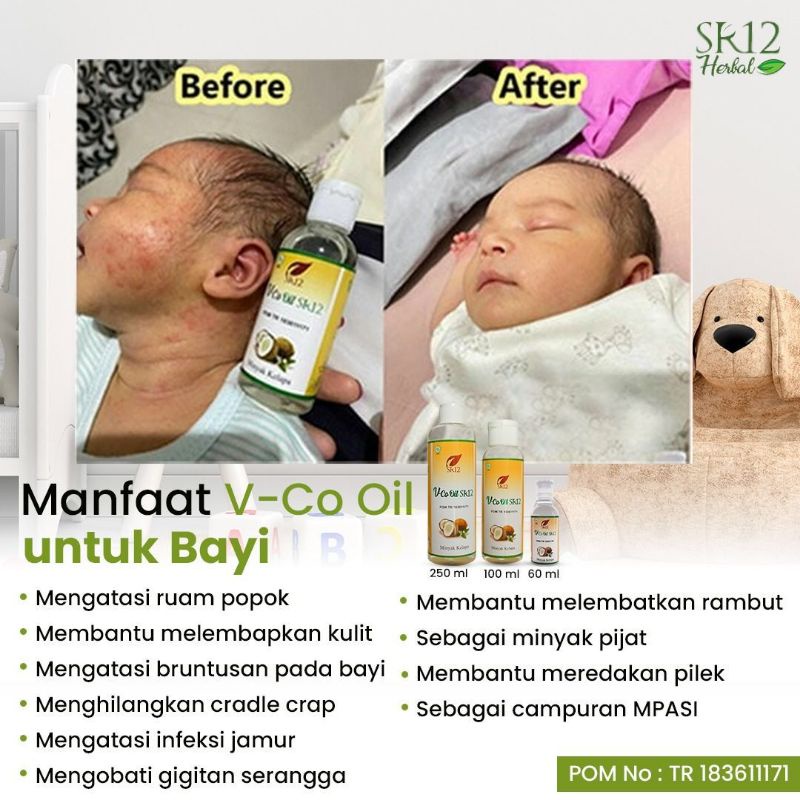 Jual VCO (Virgin Coconut Oil) | Shopee Indonesia