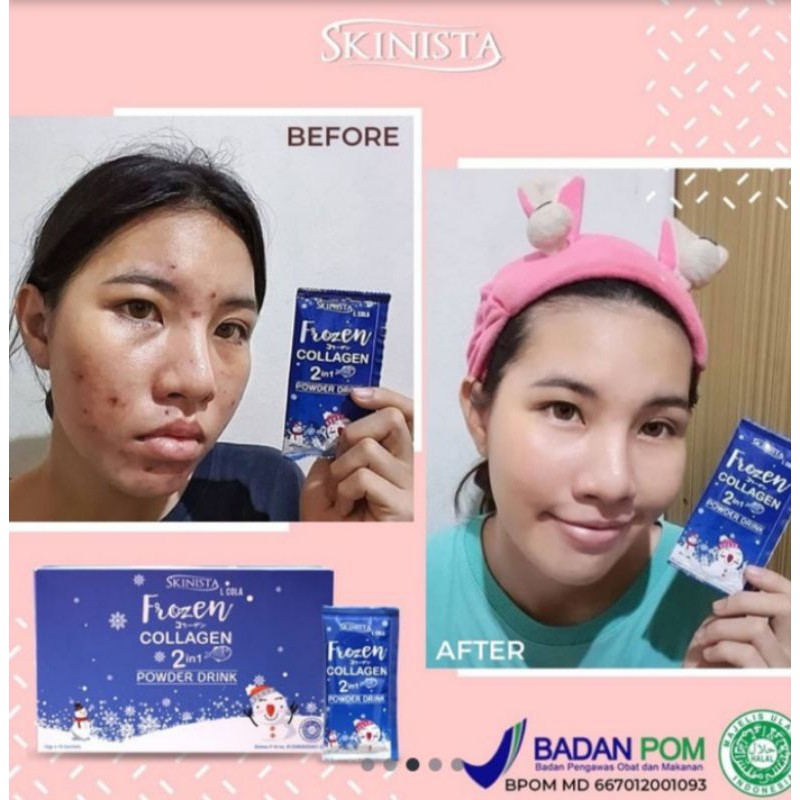 Jual Powder drink frozen collagen by skinista BPOM dan HALAL | Shopee ...