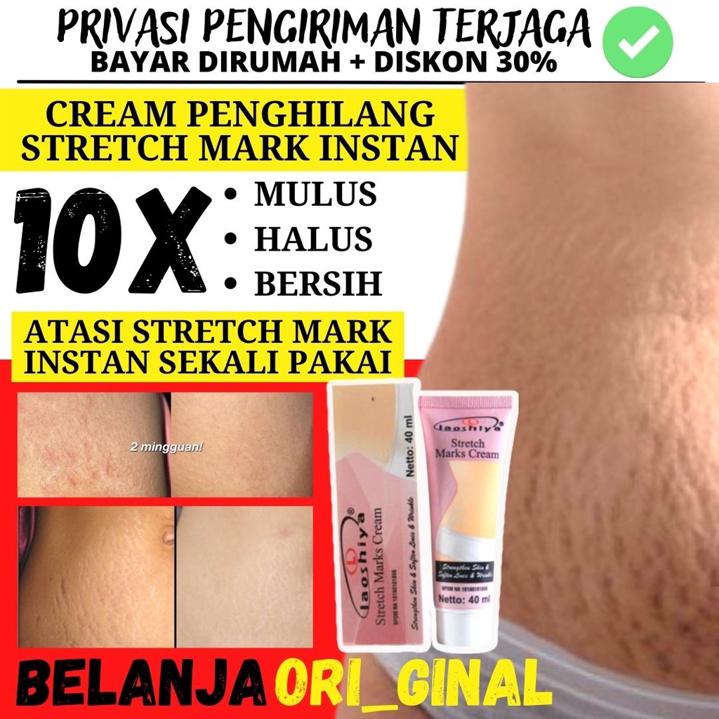 Jual PENGHILANG STRECHMARK KRIM STRECH MARK IBU HAMIL LAOSHIYA STRETCH MARKS CREAM ORIGINAL BPOM