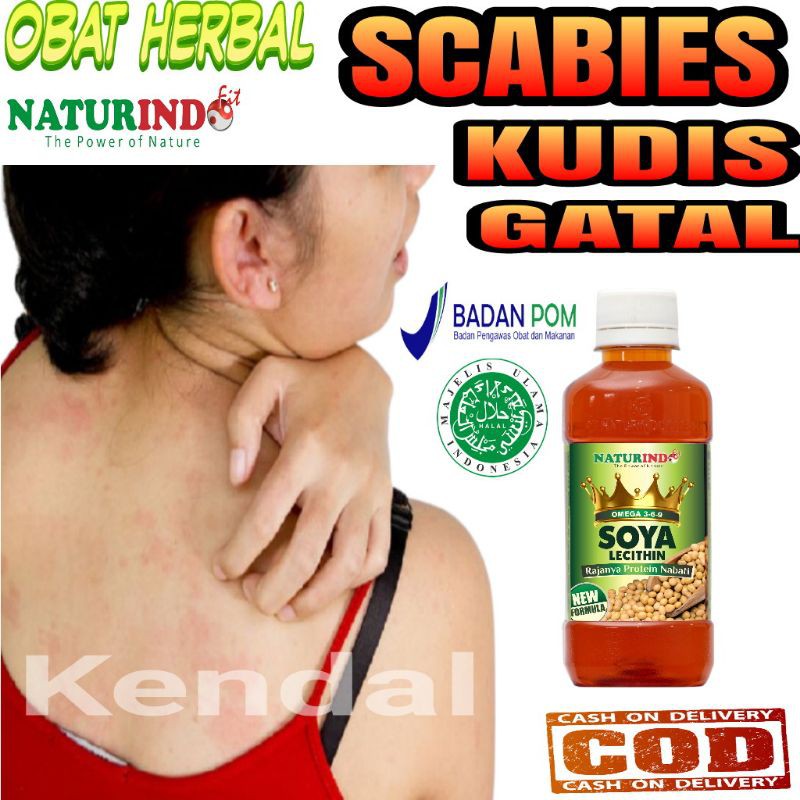 Jual Obat Scabies Kudis Gatal Anak Dan Dewasa Ampuh | Shopee Indonesia