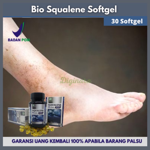 Jual Obat Bengkak Di Kaki Benjolan Pada Kaki Sakit Bengkak Di Kaki