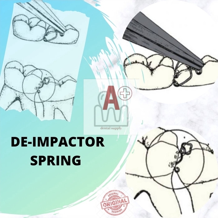 Jual Deimpactor spring / untuk menegakkan gigi molar, dynaflex, harga ...