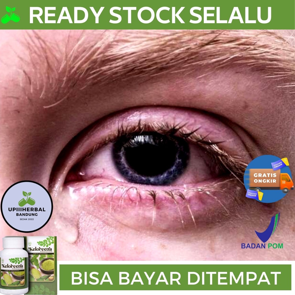 Jual Obat Gangguan Saraf Mata Obat Untuk Gangguan Saraf Mata Obat