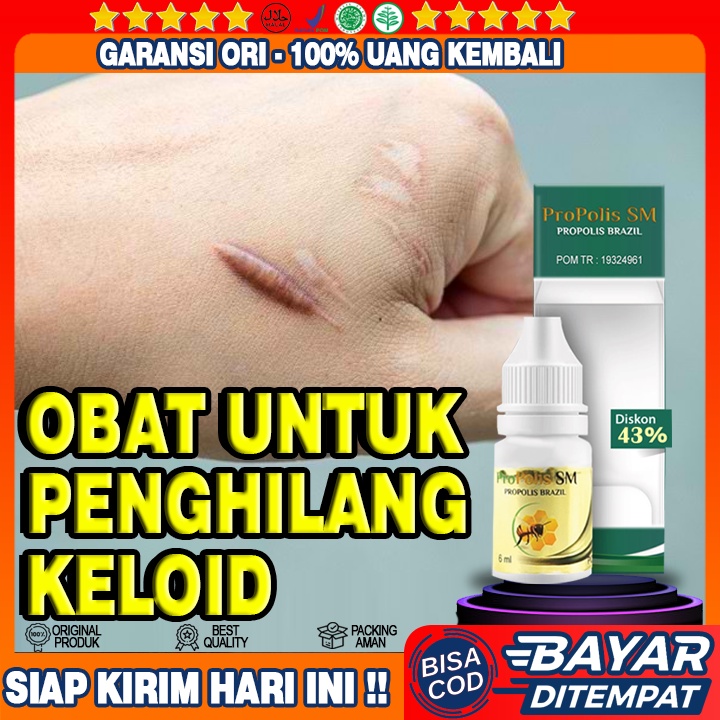 Jual Obat Keloid Obat Penumpas Daging Tumbuh Daging Jadi Penghilang