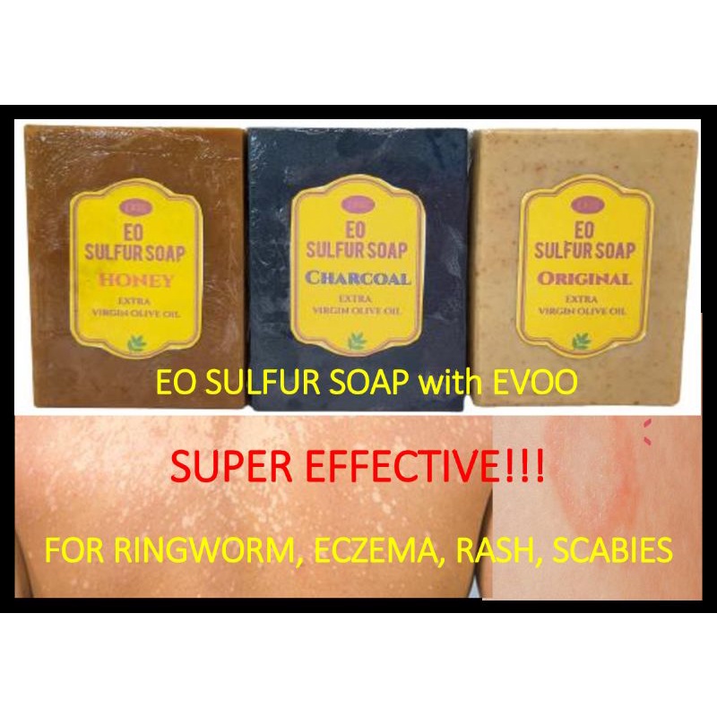 Jual Sulfur soap EO effective for scabies ringworm rash eczema Shopee