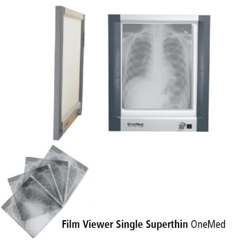 Jual Lampu Xray Viewer Single Slide ONEMED Film Viewer Single Supertin ...