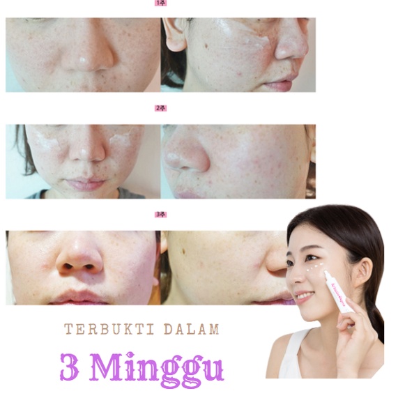 Jual Arbutin Acai - Whitening Emulsion 50ml | Shopee Indonesia