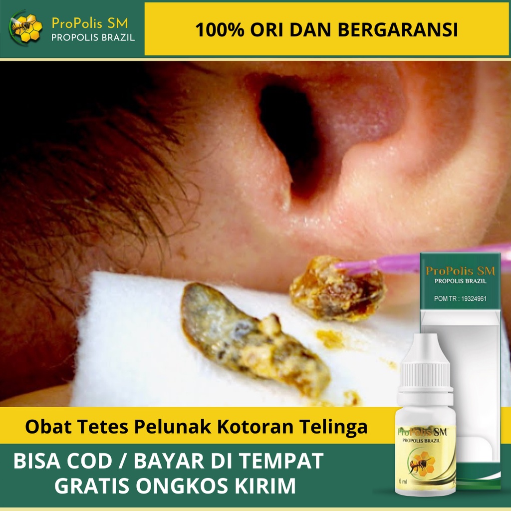 Jual Obat Tetes Pelunak Kotoran Telinga Keras Obat Penghancur Kotoran