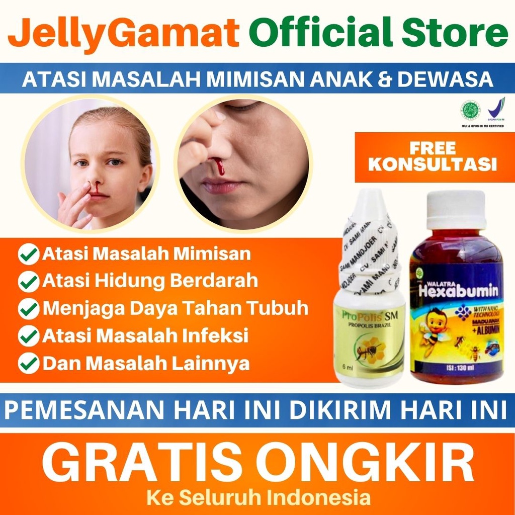 Jual Obat Mimisan Anak dan Dewasa Sering Mimisan Hidung Berdarah Hidung Keluar Darah Epistaxis