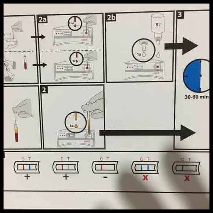 Jual BANTING HARGA HIV Whole Blood VIKIA isi 2 Test Sensitifitas 100