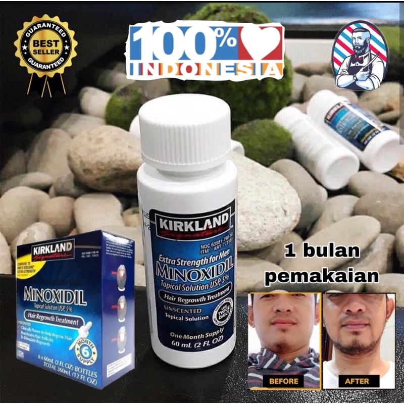 Jual Minoxidil Kirkland ORIGINAL 100% (60ml) | Shopee Indonesia